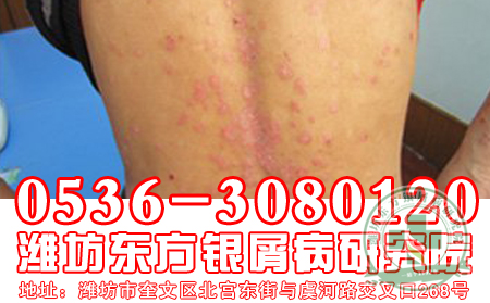 强身健体的红色战士——大枣